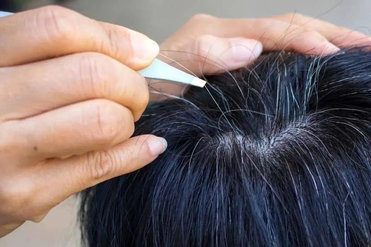 سفیدی مو سفیدشدن مو