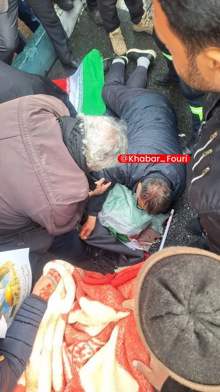 اصابت ترکش بمب اسراییلی به یک فرد در راهپیمایی روز قدس