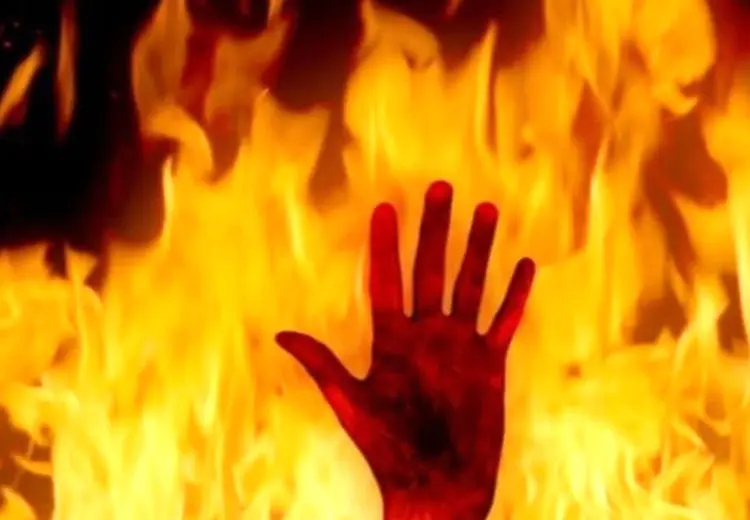 جان باختن جوان اهوازی پس از اقدام به خودسوزی