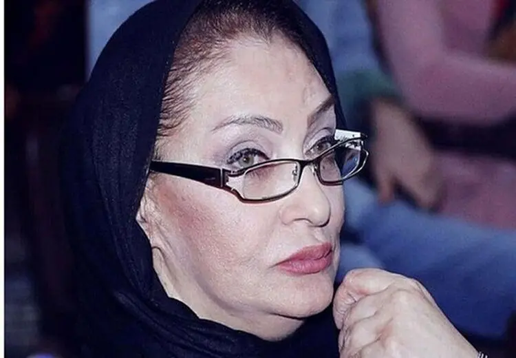 بازیگر مشهور زن سینمای دهه 70 در کما است
