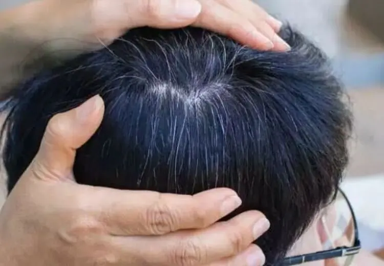 یافته‌ای جدید درباره سفیدشدن مو