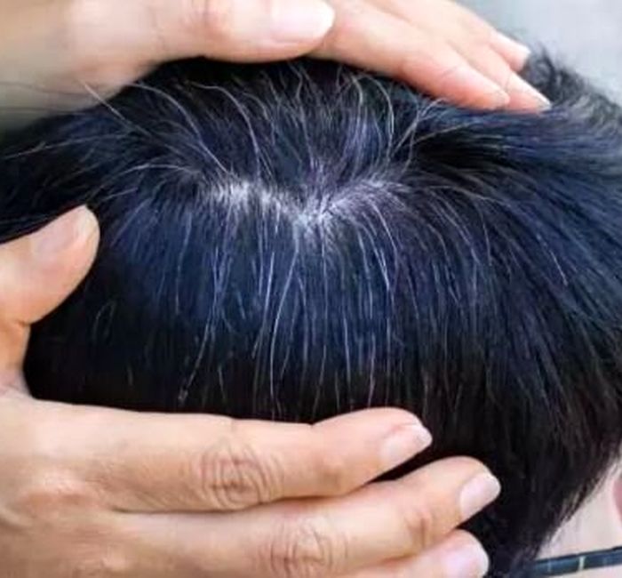 یافته‌ای جدید درباره سفیدشدن مو