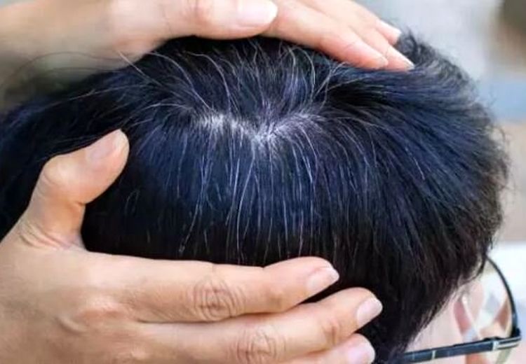 یافته‌ای جدید درباره سفیدشدن مو