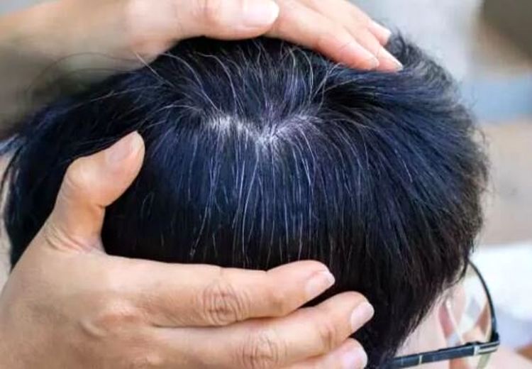 یافته‌ای جدید درباره سفیدشدن مو