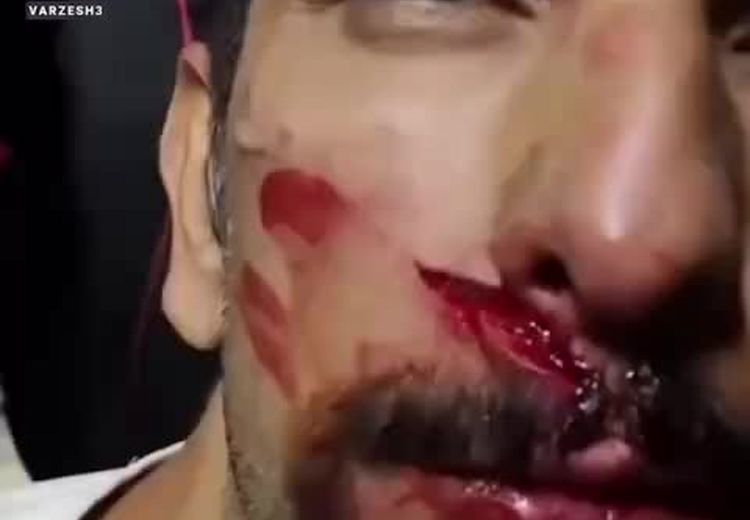  حادثه هولناک در ورزشگاه پارس شیراز ! / فیلم
