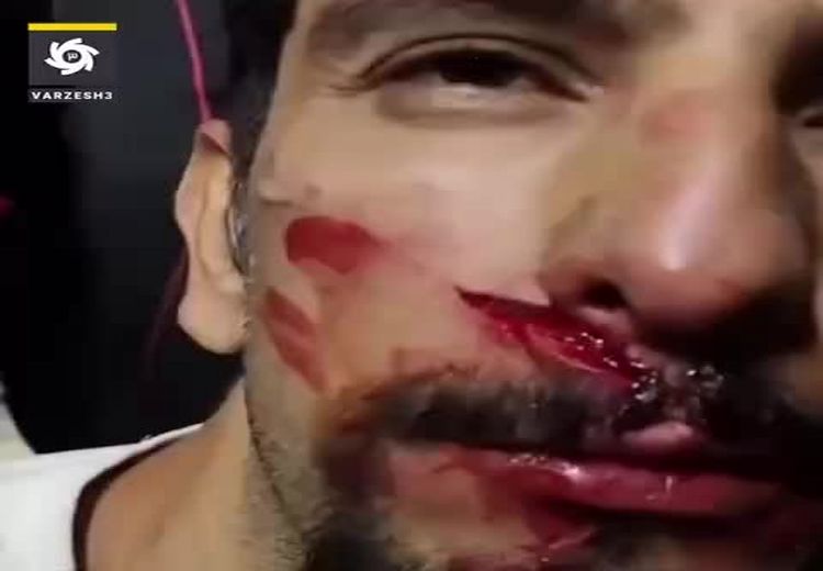  حادثه هولناک در ورزشگاه پارس شیراز ! / فیلم