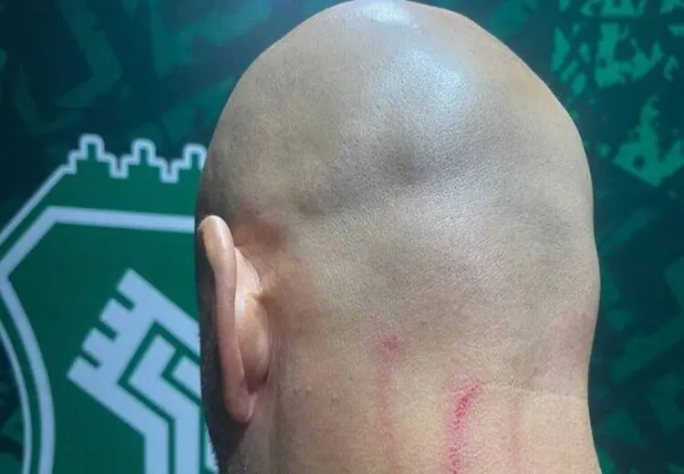 حمله به مربی خارجی استقلال و جراحت جورجیوس + عکس