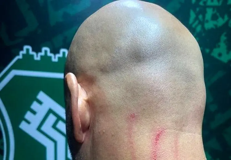 حمله به مربی خارجی استقلال و جراحت جورجیوس + عکس