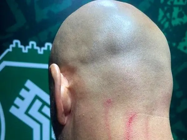 حمله به مربی خارجی استقلال و جراحت جورجیوس + عکس