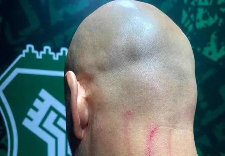 حمله به مربی خارجی استقلال و جراحت جورجیوس + عکس