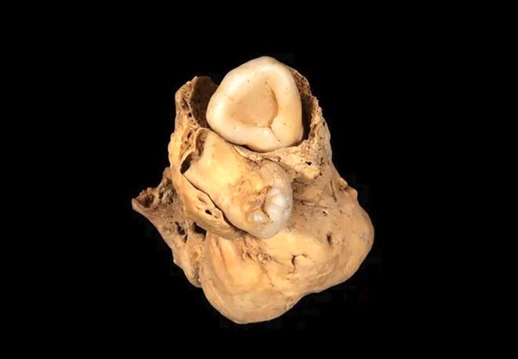 کشف تومور عجیب در فسیل 3 هزار ساله + عکس
