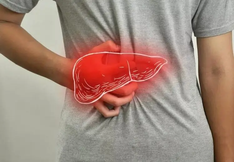 افراد لاغر هم به «کبد چرب» مبتلا می‌شوند؟