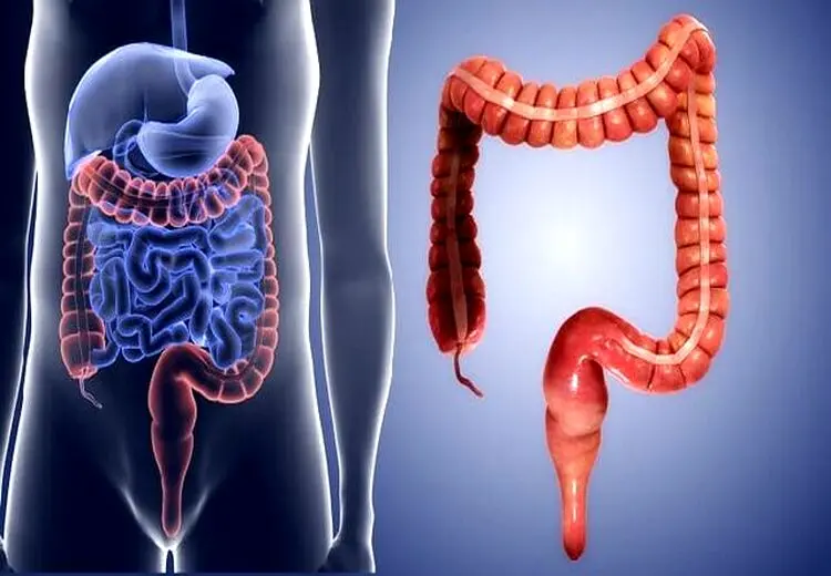 افزایش انسداد گوارشی ناشی از مصرف بی‌رویه «انار» و «خرمالو» در کودکان