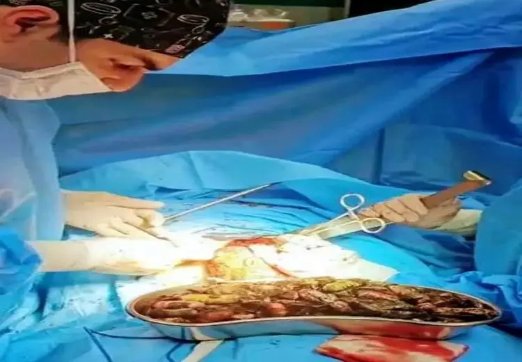 خارج کردن ۹۰ بسته مواد مخدر از معده و روده فردی در کرج + عکس