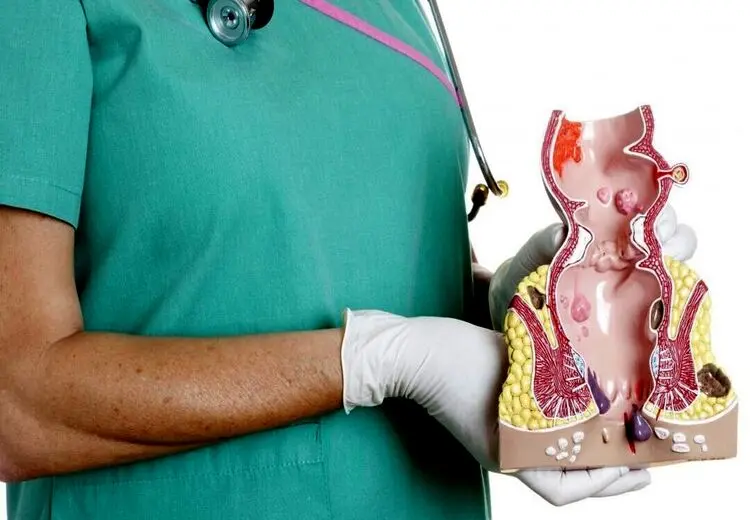 بواسیر؛ از علت تا چگونگی درمان و مراقبت