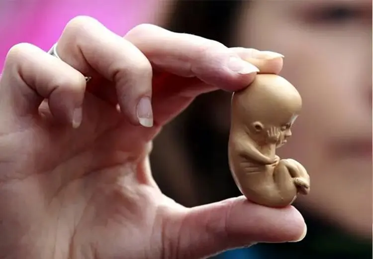 آمار سقط جنین در ایران چقدر است؟