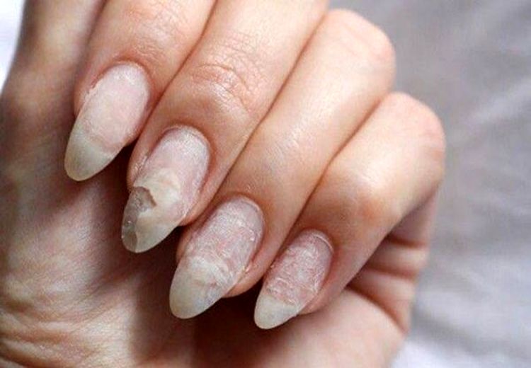 علت تغییر رنگ ناخن‌ها چیست؟