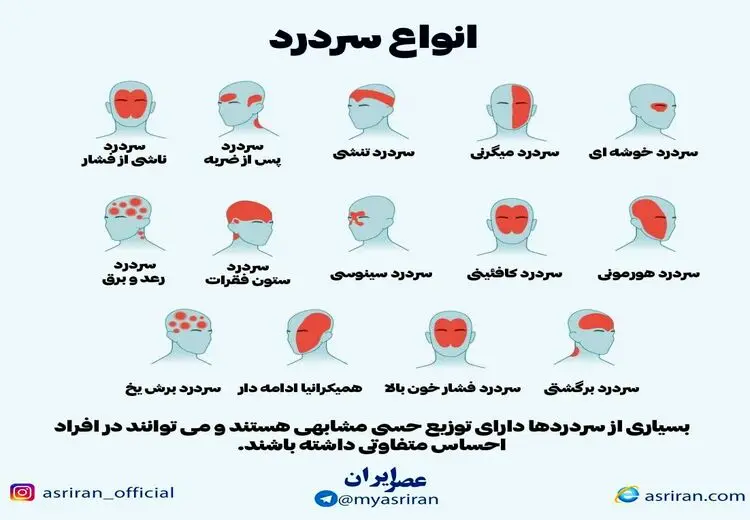  انواع سردرد را بشناسیم/ اینفوگرافی 