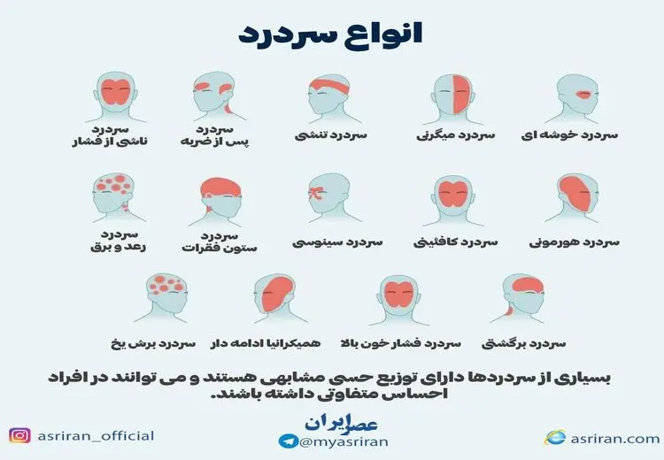  انواع سردرد را بشناسیم/ اینفوگرافی 