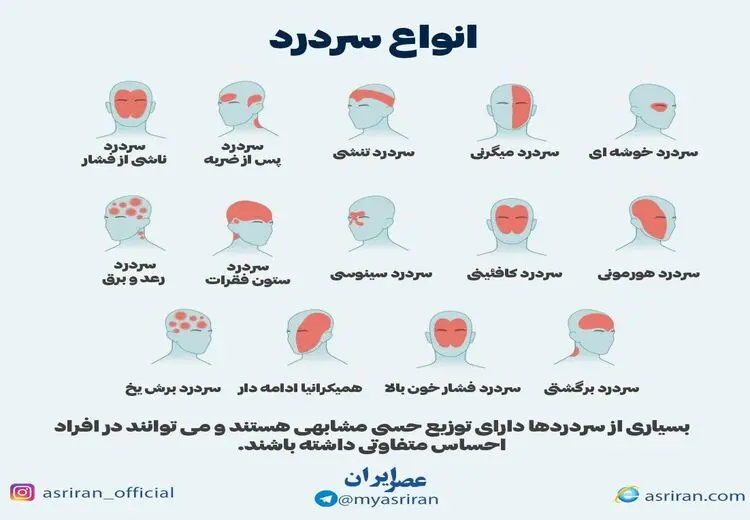  انواع سردرد را بشناسیم/ اینفوگرافی 