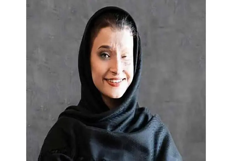 استوری یکی از قربانیان اسیدپاشی اصفهان خطاب به رادان