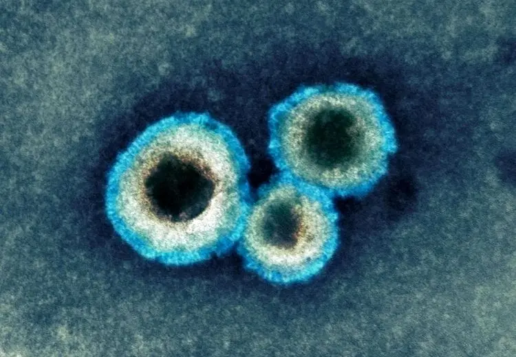 ماجرای شیوع ویروس جدید در قم چیست؟