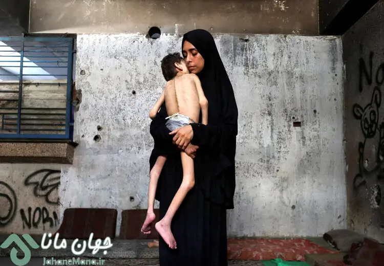 تصاویر دردناک از قحطی در غزه