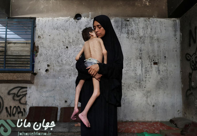 تصاویر دردناک از قحطی در غزه