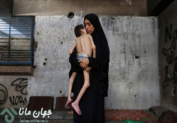 تصاویر دردناک از قحطی در غزه