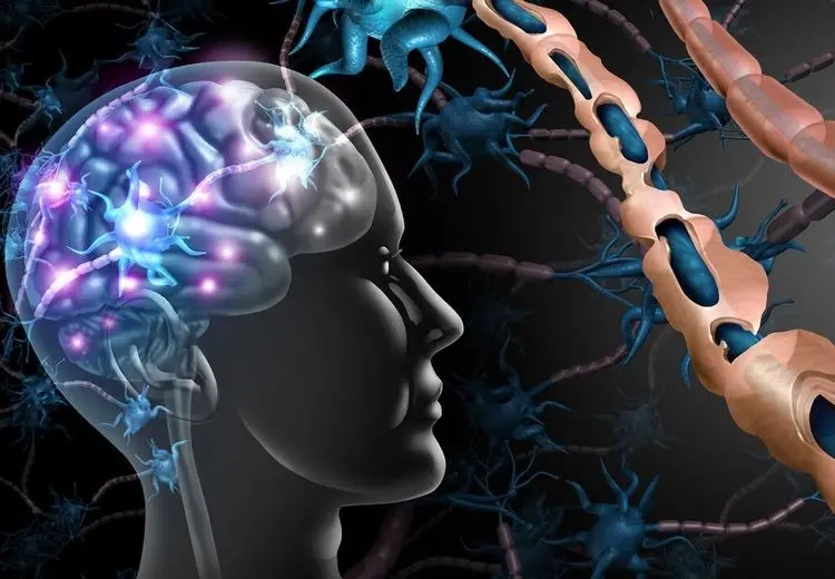 چه کسانی بیشتر دچار بیماری ام اس می‌شوند؟