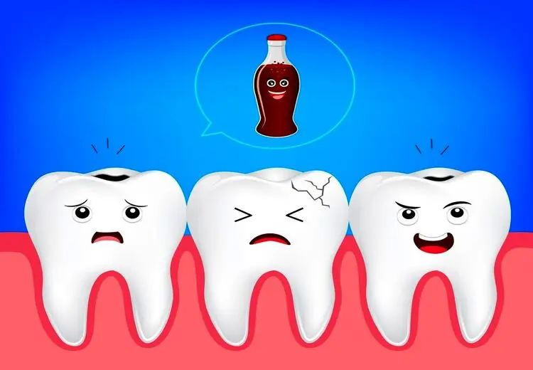 نوشابه چه بلایی سر دندان می‌آورد؟