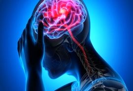  برداشتن رحم احتمال سکته مغزی را افزایش میدهد؟