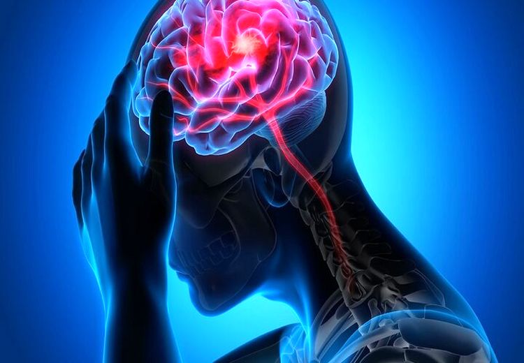  برداشتن رحم احتمال سکته مغزی را افزایش میدهد؟