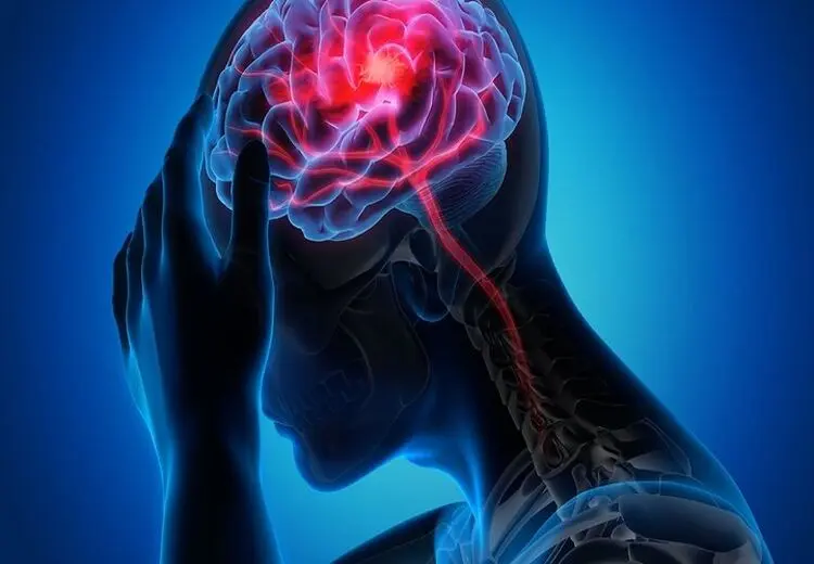  برداشتن رحم احتمال سکته مغزی را افزایش میدهد؟