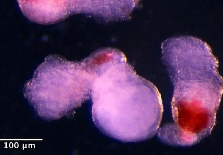 قبل از حمله به انستیتو پاستور نمونه‌های سلولی خارج شده بودند