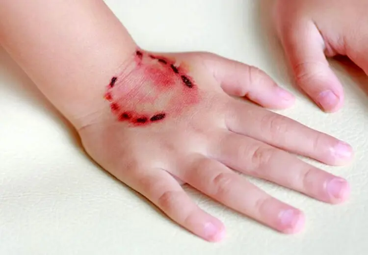 ثبت ۱۴ مرگ به دلیل هاری ناشی از سگ، گرگ شغال، گاو و کفتار