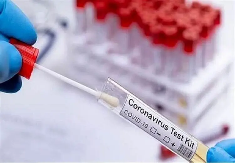 فرانشیز تست تشخیص کرونا رایگان شد