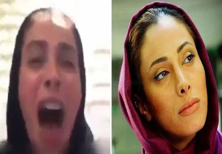 واکسن کرونا و نکته فراموش‌شده از سوی خانم سلبریتی