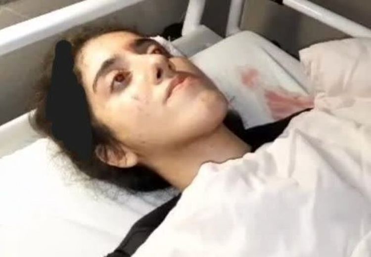 دختر۲۰ ساله رشتی در تجمعات کشته شد؟/ پلیس: او در ازدحام تجمع کنندگان آسیب دیده