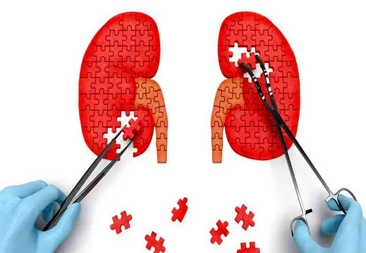 این علائم میگوید شما نارسایی کلیه دارید