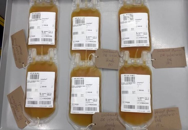 تزریق پلاسمای خون نجات‌یافتگان کرونا به بیماران کرونایی