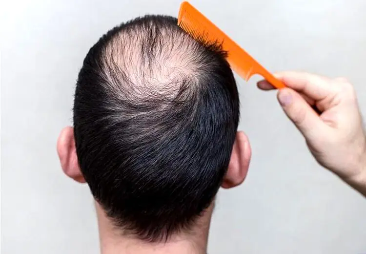 ۴ میوه مغذی که برای رشد مو مفید است