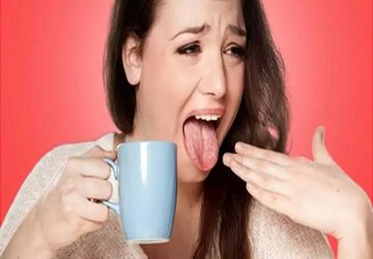 با زبان سوخته چه کنیم؟