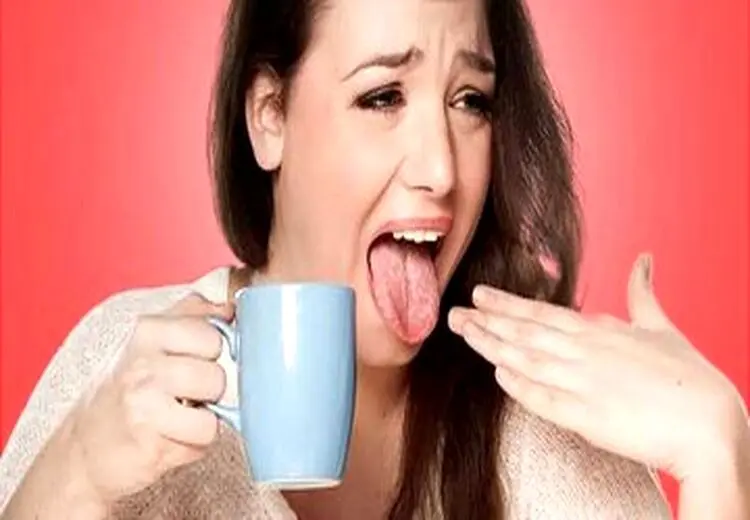 با زبان سوخته چه کنیم؟