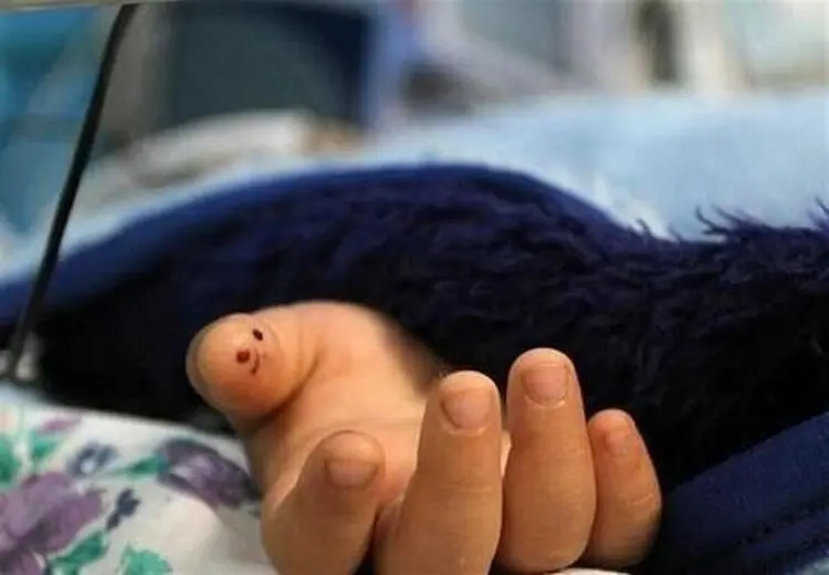 شکایت از کادر درمان به دلیل مرگ پسر خردسال با چاقوی میوه خوری