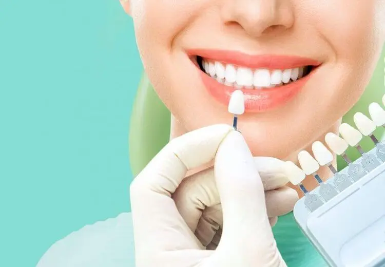 چگونه از لمینت و کامپوزیت دندان مراقبت کنیم؟ + باید ها و نباید ها
​