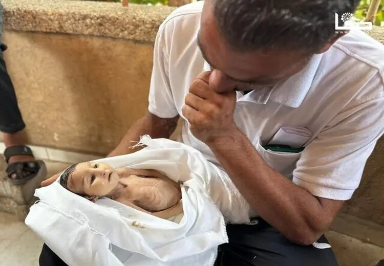 شهادت ۳ نفر در غزه در پی گرسنگی و سوء تغذیه