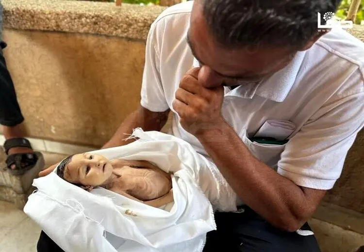 شهادت ۳ نفر در غزه در پی گرسنگی و سوء تغذیه