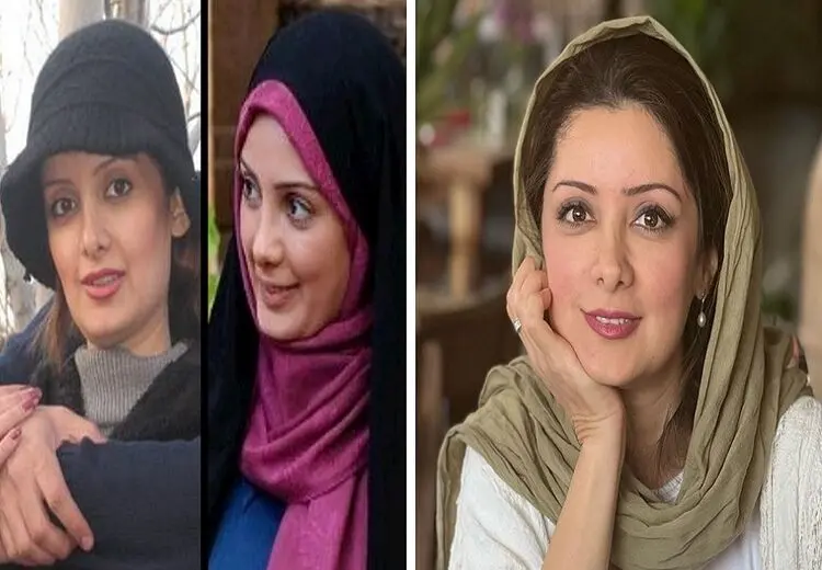 شگفت‌زدگی کاربران فضای مجازی از تغییر چهره خانم بازیگر!