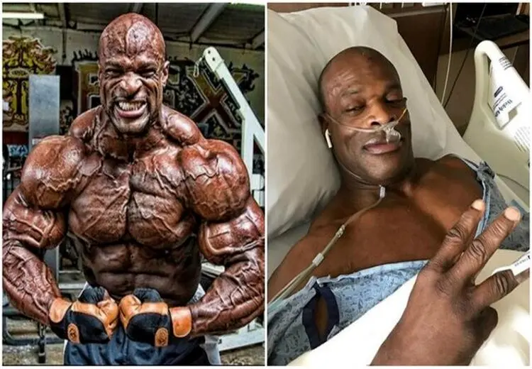قهرمان افسانه‌ای پرورش اندام دنیا فلج شد + تصویر